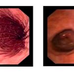 Nước sinh hoạt bị ô nhiễm tiềm ẩn nguy cơ mắc bệnh